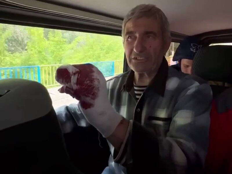 На околицях Вовчанська окупанти зайшли в будинок і відстрелили палець 74-річному жителю – прокуратура